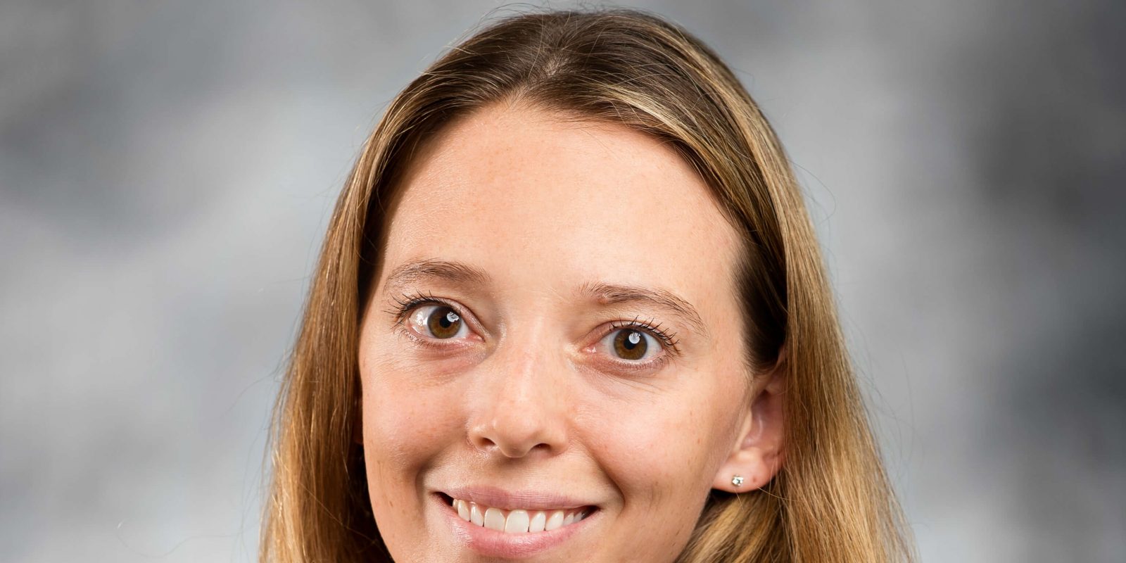 Varicose Veins: Causes, Common Misconceptions, and Latest Treatment Available in the Market [Interview][Transcript]