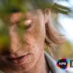 Australian Men Beware of Skin Cancer Risk