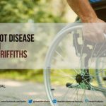 Diabetes Amputations
