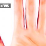 Researchers Designed Electronic Skin For Amputees