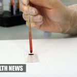 Inexpensive & Groundbreaking Blood Test Can Quickly Diagnose Hepatitis B patients In Africa