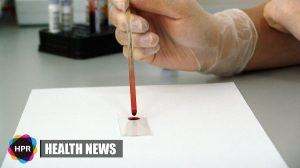 Inexpensive & Groundbreaking Blood Test Can Quickly Diagnose Hepatitis B patients In Africa