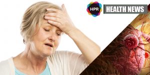 Altitude Sickness Drug Can Benefit Glioblastoma Patients