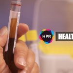 BLood Test - Lung Cancer Detection