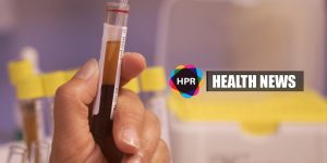 BLood Test - Lung Cancer Detection