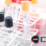 Hidden Traces of Stool Blood May Predict Mortality Risk