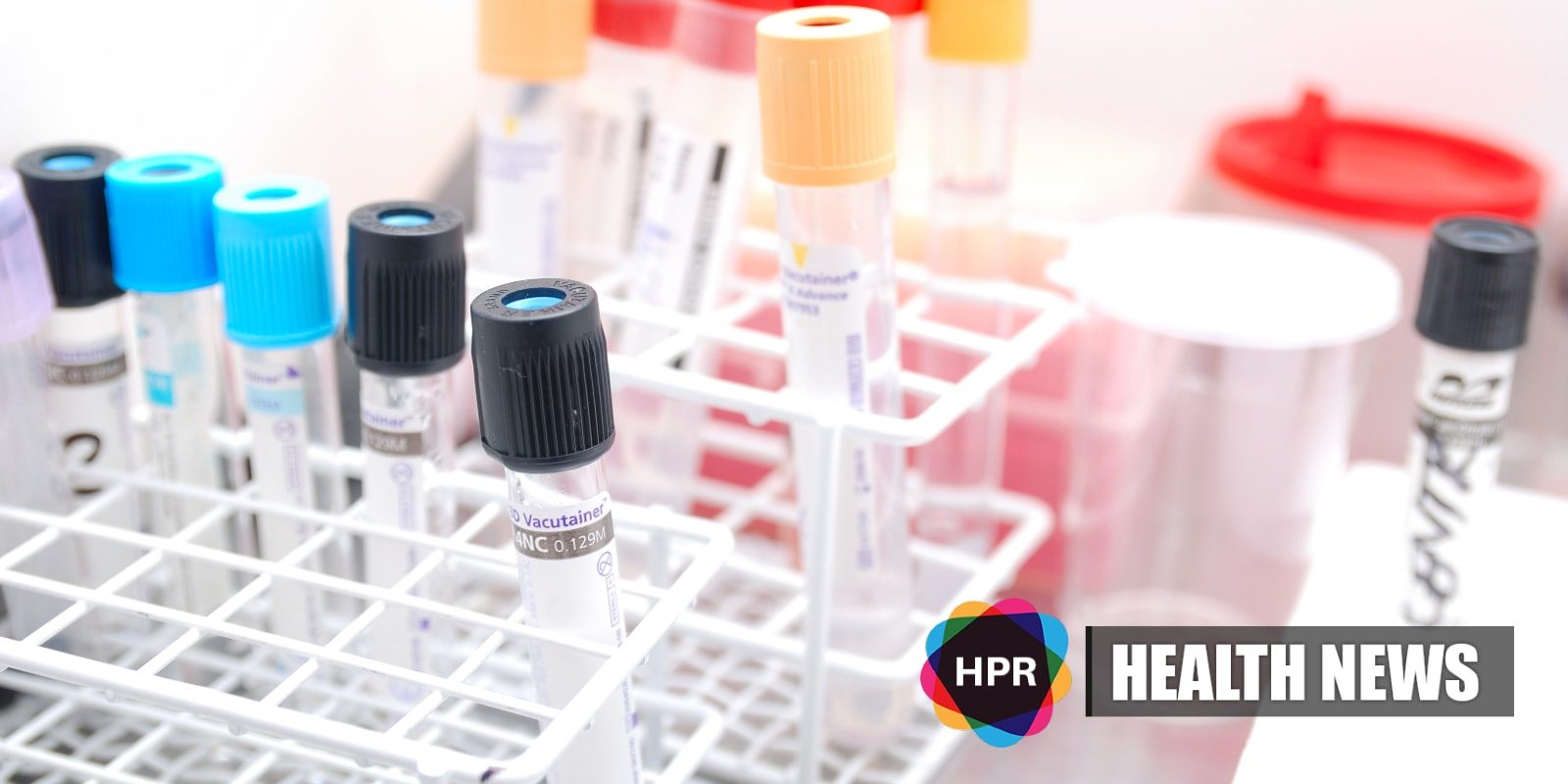 Hidden Traces of Blood in Stool May Predict Mortality