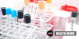 Hidden Traces of Stool Blood May Predict Mortality Risk