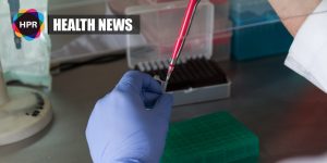 Early Stages of Melanoma Can Now Be Detected Through Blood Test