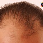 Can Hair Loss and Skin Wrinkles Be Reversed