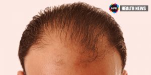 Can Hair Loss and Skin Wrinkles Be Reversed