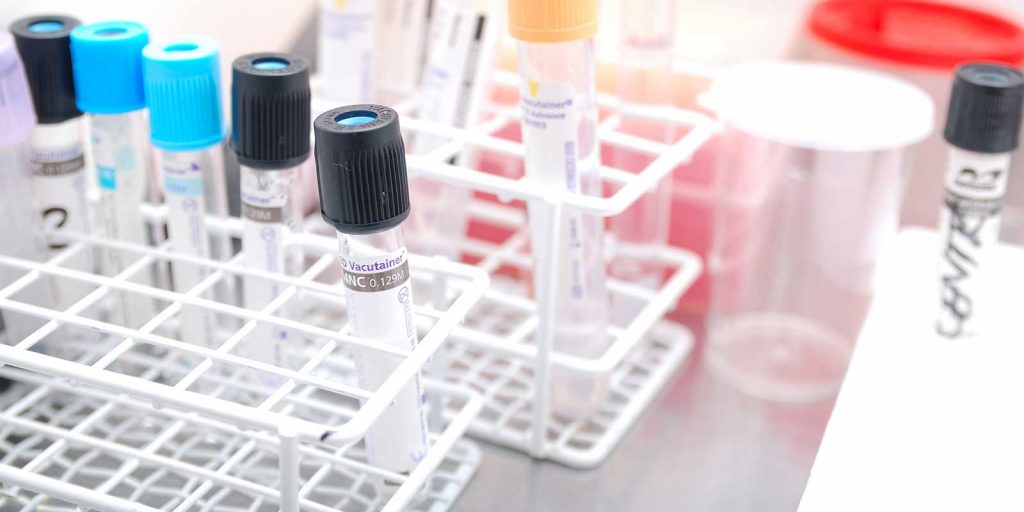 PID 3486 Padma Sundar - The Latest in Colorectal Cancer Detection
