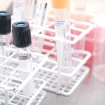 PID 3486 Padma Sundar - The Latest in Colorectal Cancer Detection