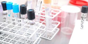 PID 3486 Padma Sundar - The Latest in Colorectal Cancer Detection