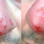 PID 3667 HPR - Neal Howard - Dr. Hugh McTavish - Herpes Simplex 1 and 2 Treatments