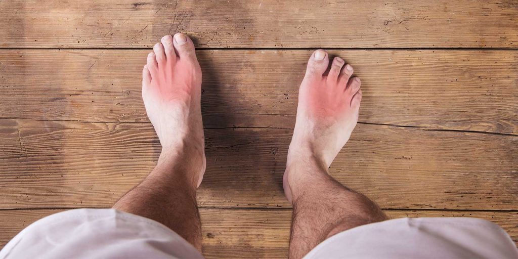 PID 3690 HPR - N. Lawrence Edwards - The Gout & Uric Acid Education Society International Advisory Council