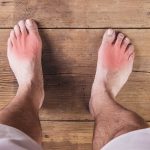 PID 3690 HPR - N. Lawrence Edwards - The Gout & Uric Acid Education Society International Advisory Council