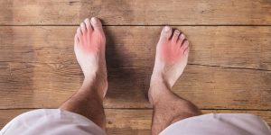 PID 3690 HPR - N. Lawrence Edwards - The Gout & Uric Acid Education Society International Advisory Council