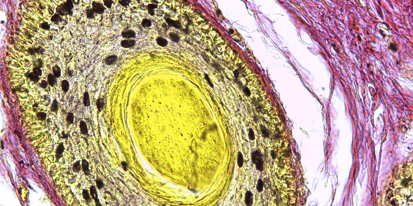 Understanding skin cancer treatment options