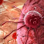 Salivary-gland-tumors,-how-genomic-testing-helps-cure-cancer