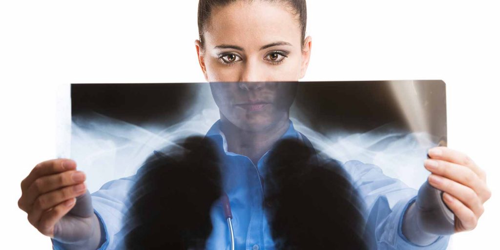 monotherapy-for-patients-with-metastatic-small-cell-lung-cancer