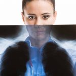 monotherapy-for-patients-with-metastatic-small-cell-lung-cancer