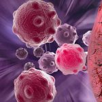 Attacking-brain-cancer-from-a-completely-new-angle-with-an-industry-first-approach