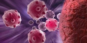 Attacking-brain-cancer-from-a-completely-new-angle-with-an-industry-first-approach