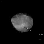 Kubtec-Tomosynthesis-System-for-Breast-Cancer-Imaging