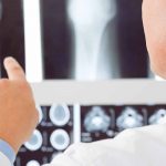 The-Importance-of-Bone-Health