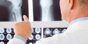 The-Importance-of-Bone-Health