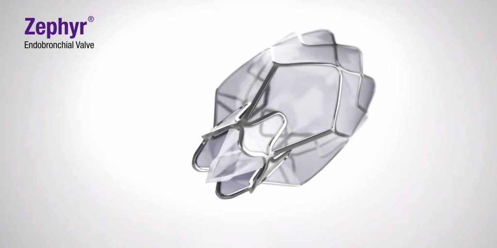 The-Zephyr-Endobronchial-Valve-Spectrum-Health
