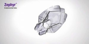 The-Zephyr-Endobronchial-Valve-Spectrum-Health