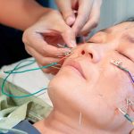 The-Acupuncture-Now-Foundation