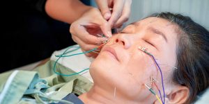 The-Acupuncture-Now-Foundation