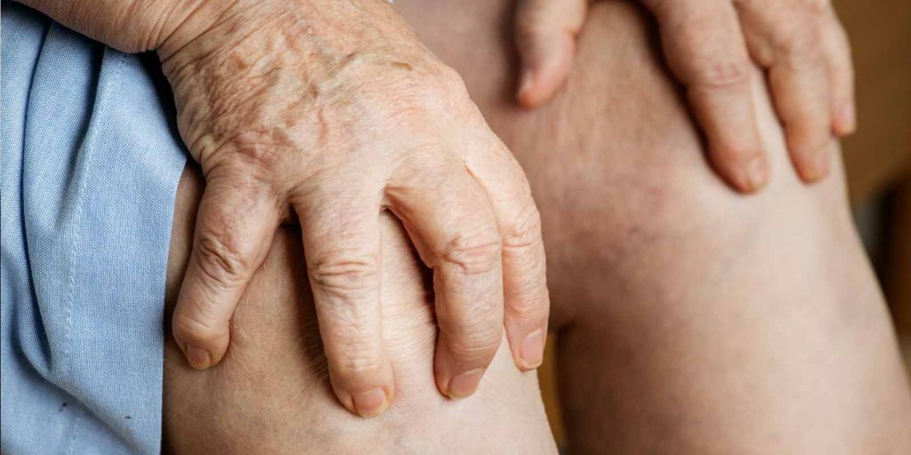 Chronic-Kidney-Disease-(CKD)-and-Gout