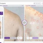 Miiskin-and-Skin-Cancer-Foundation---Self-Skin-Exams