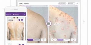 Miiskin-and-Skin-Cancer-Foundation---Self-Skin-Exams