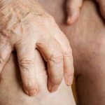 New-2020-ACR-Guideline-for-Gout