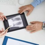 Patient-with-Living-with-Advanced-Lung-Cancer