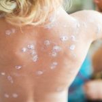 Health-Security-and-Smallpox-Potential