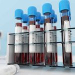 COVID-19-Convalescent-Blood-Plasma-Trials-Underway