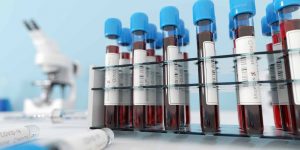COVID-19-Convalescent-Blood-Plasma-Trials-Underway
