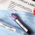 SEMA4---COVID-19-Viral-and-Antibody-Testing