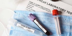 SEMA4---COVID-19-Viral-and-Antibody-Testing