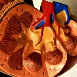 Chronic-Kidney-Disease-and-Anemia