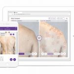 Miiskin-Pro---Teledermatology