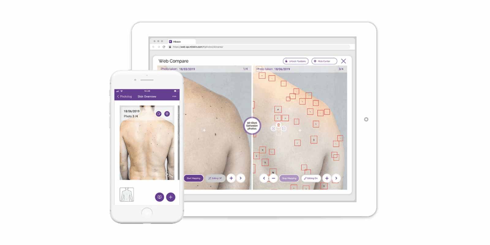 Miiskin Pro – Teledermatology