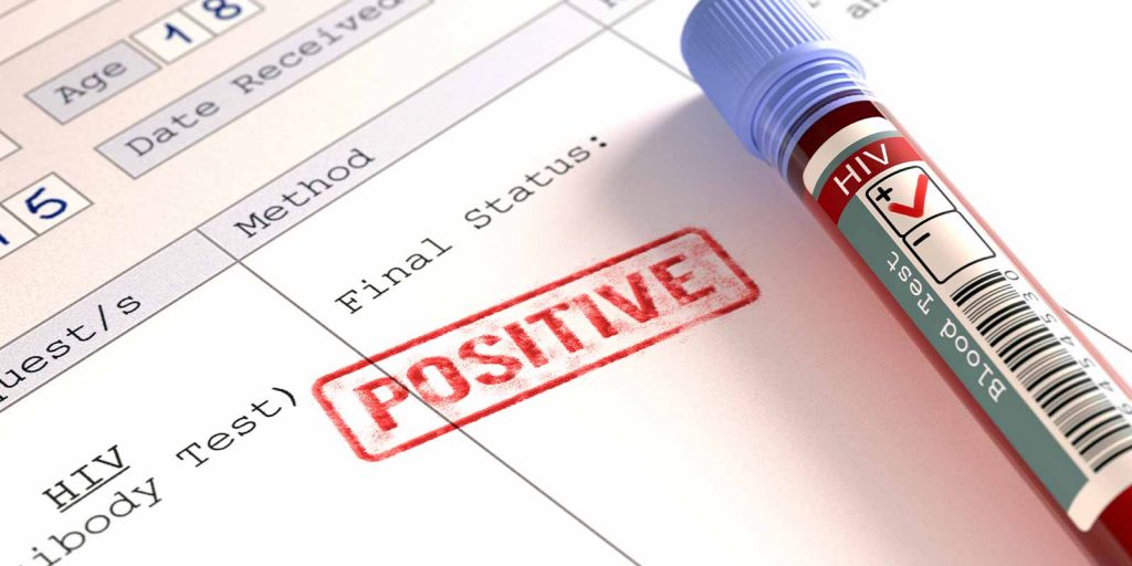 Disproportionate-Impact-on-Latinx-LGBTQ+-Men_s-Access-to-Preventive-Care-and-HIV-Treatment