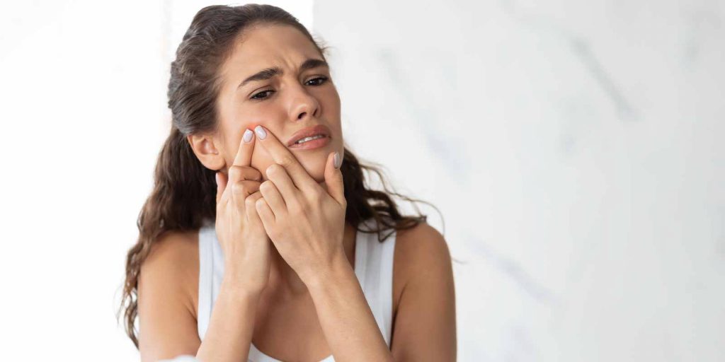 Galderma & AKLIEF Cream -Me Being Me Campaign and the Acne Burden